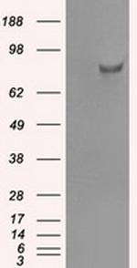 SATB1 Antibody in Western Blot (WB)