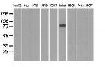 SATB1 Antibody in Western Blot (WB)