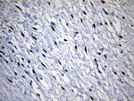 SATB2 Antibody in Immunohistochemistry (Paraffin) (IHC (P))