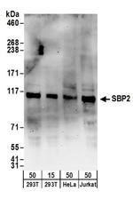 SBP2 Antibody in Western Blot (WB)