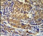 SBSN Antibody in Immunohistochemistry (IHC)