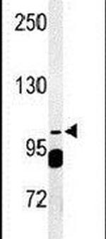 SEC24A Antibody in Western Blot (WB)