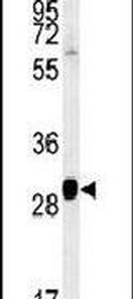 SEC31B Antibody in Western Blot (WB)