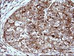 SCAMP2 Antibody in Immunohistochemistry (Paraffin) (IHC (P))