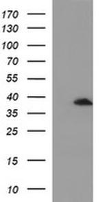 SCAMP2 Antibody in Western Blot (WB)
