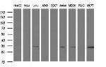 SCAMP2 Antibody in Western Blot (WB)