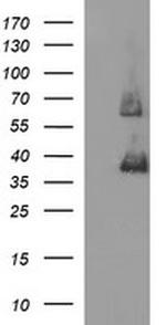 SCAMP2 Antibody in Western Blot (WB)