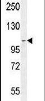 SCARF2 Antibody in Western Blot (WB)