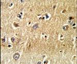 SCFD1 Antibody in Immunohistochemistry (IHC)