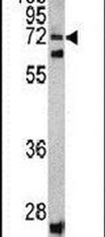 SCFD1 Antibody in Western Blot (WB)
