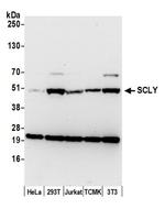 SCLY Polyclonal Antibody