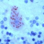 SCN1A Antibody in Immunohistochemistry (IHC)