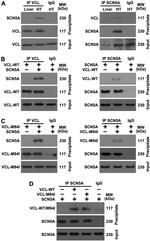 SCN5A Antibody in Immunoprecipitation (IP)