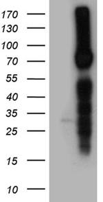 SCNN1A Antibody in Western Blot (WB)