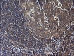 SCP2 Antibody in Immunohistochemistry (Paraffin) (IHC (P))