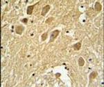 SCRN1 Antibody in Immunohistochemistry (IHC)