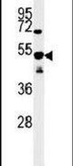SCRN1 Antibody in Western Blot (WB)