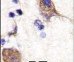 SCYL2 Antibody in Immunohistochemistry (IHC)
