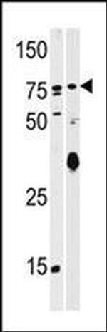 SCYL2 Antibody in Western Blot (WB)