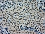 SCYL3 Antibody in Immunohistochemistry (Paraffin) (IHC (P))