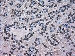 SCYL3 Antibody in Immunohistochemistry (Paraffin) (IHC (P))
