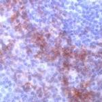 CD138 Antibody in Immunohistochemistry (IHC)