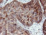 SDCBP Antibody in Immunohistochemistry (Paraffin) (IHC (P))
