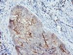 SDCBP Antibody in Immunohistochemistry (Paraffin) (IHC (P))