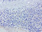 SDCBP Antibody in Immunohistochemistry (Paraffin) (IHC (P))
