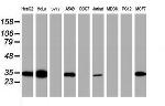SDCBP Antibody in Western Blot (WB)