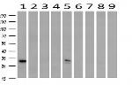 SDCBP Antibody in Western Blot (WB)