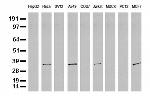 SDCBP Antibody in Western Blot (WB)