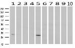 SDCBP Antibody in Western Blot (WB)