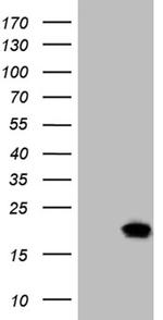 SDHAF1 Antibody in Western Blot (WB)