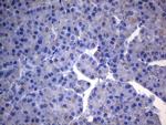SDHB Antibody in Immunohistochemistry (Paraffin) (IHC (P))