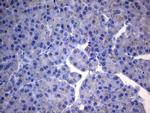 SDHB Antibody in Immunohistochemistry (Paraffin) (IHC (P))