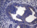 SDHB Antibody in Immunohistochemistry (Paraffin) (IHC (P))