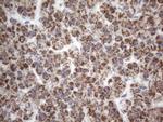 SDHB Antibody in Immunohistochemistry (Paraffin) (IHC (P))