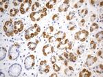 SDHB Antibody in Immunohistochemistry (Paraffin) (IHC (P))