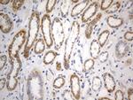 SDHB Antibody in Immunohistochemistry (Paraffin) (IHC (P))