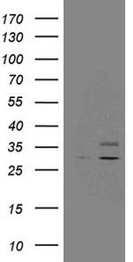 SDHB Antibody in Western Blot (WB)