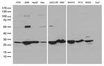 SDHB Antibody in Western Blot (WB)
