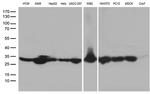 SDHB Antibody in Western Blot (WB)