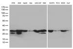 SDHB Antibody in Western Blot (WB)