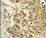 SDPR Antibody in Immunohistochemistry (IHC)