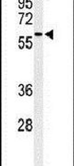 SDPR Antibody in Western Blot (WB)