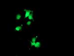 SDS Antibody in Immunocytochemistry (ICC/IF)
