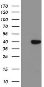 SDS Antibody in Western Blot (WB)