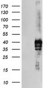 SDS Antibody in Western Blot (WB)