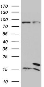 SEC11A Antibody in Western Blot (WB)